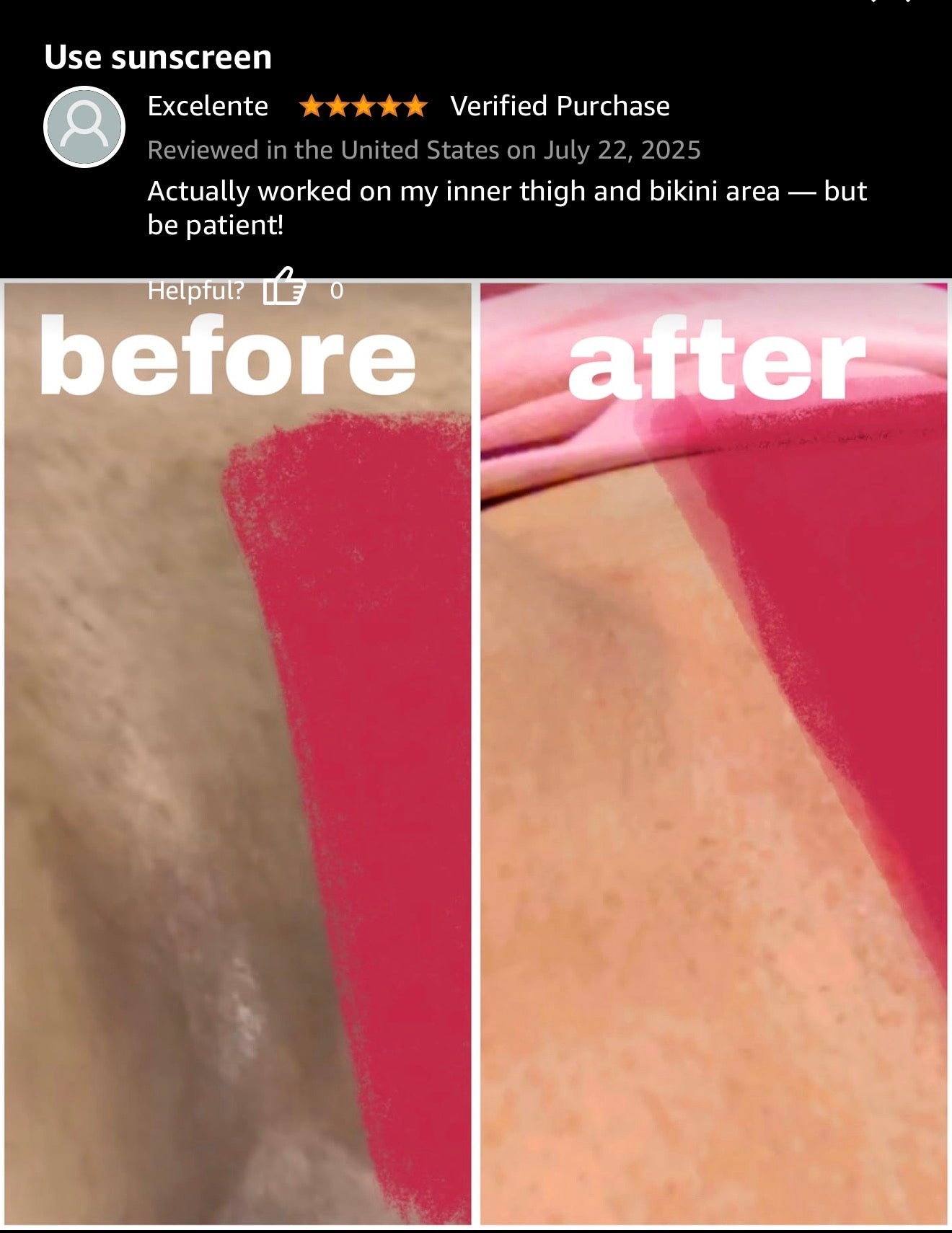 CHROMEBABEE BADDIE SERUM 💅🏼