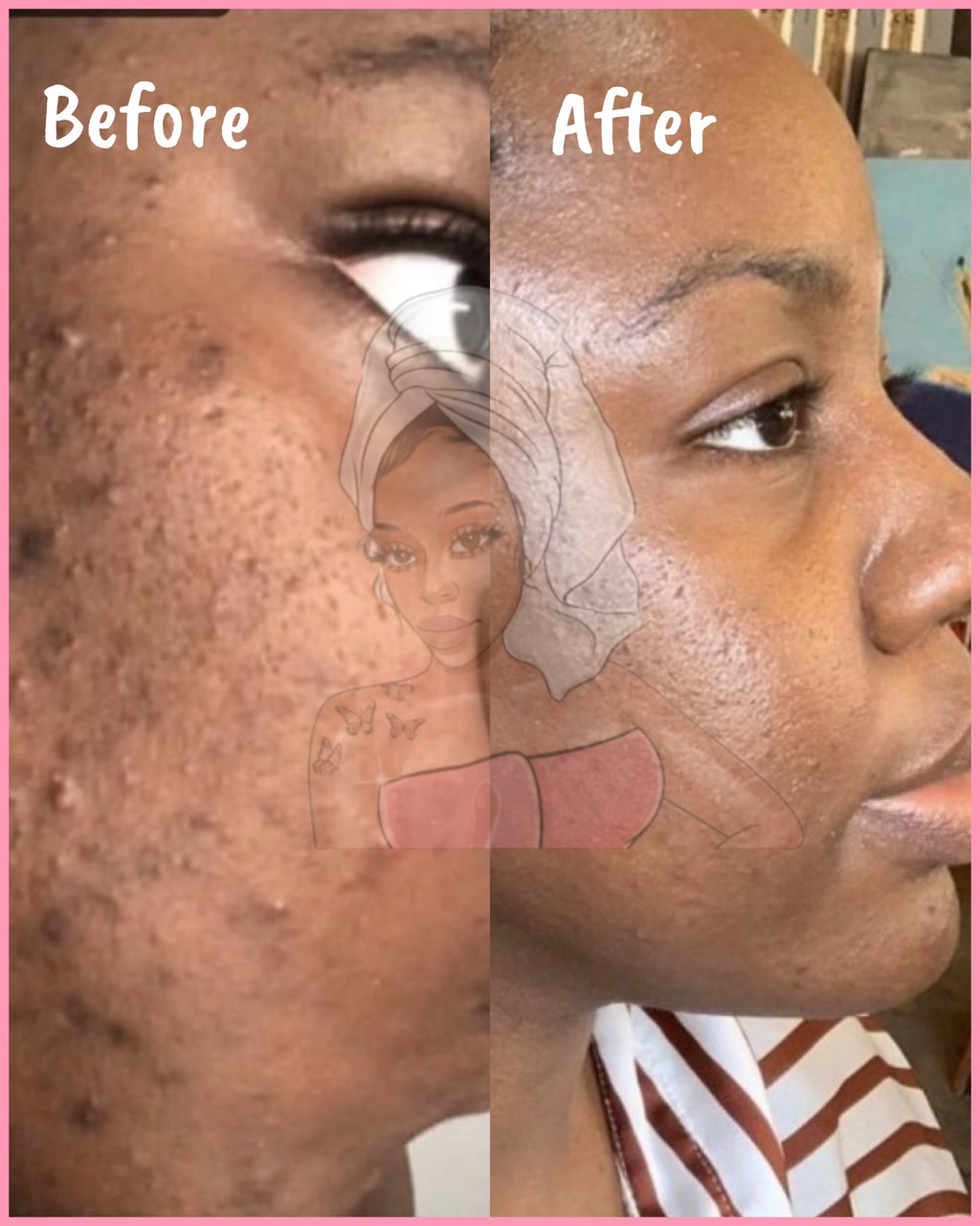 CHROMEBABEE BADDIE SERUM 💅🏼