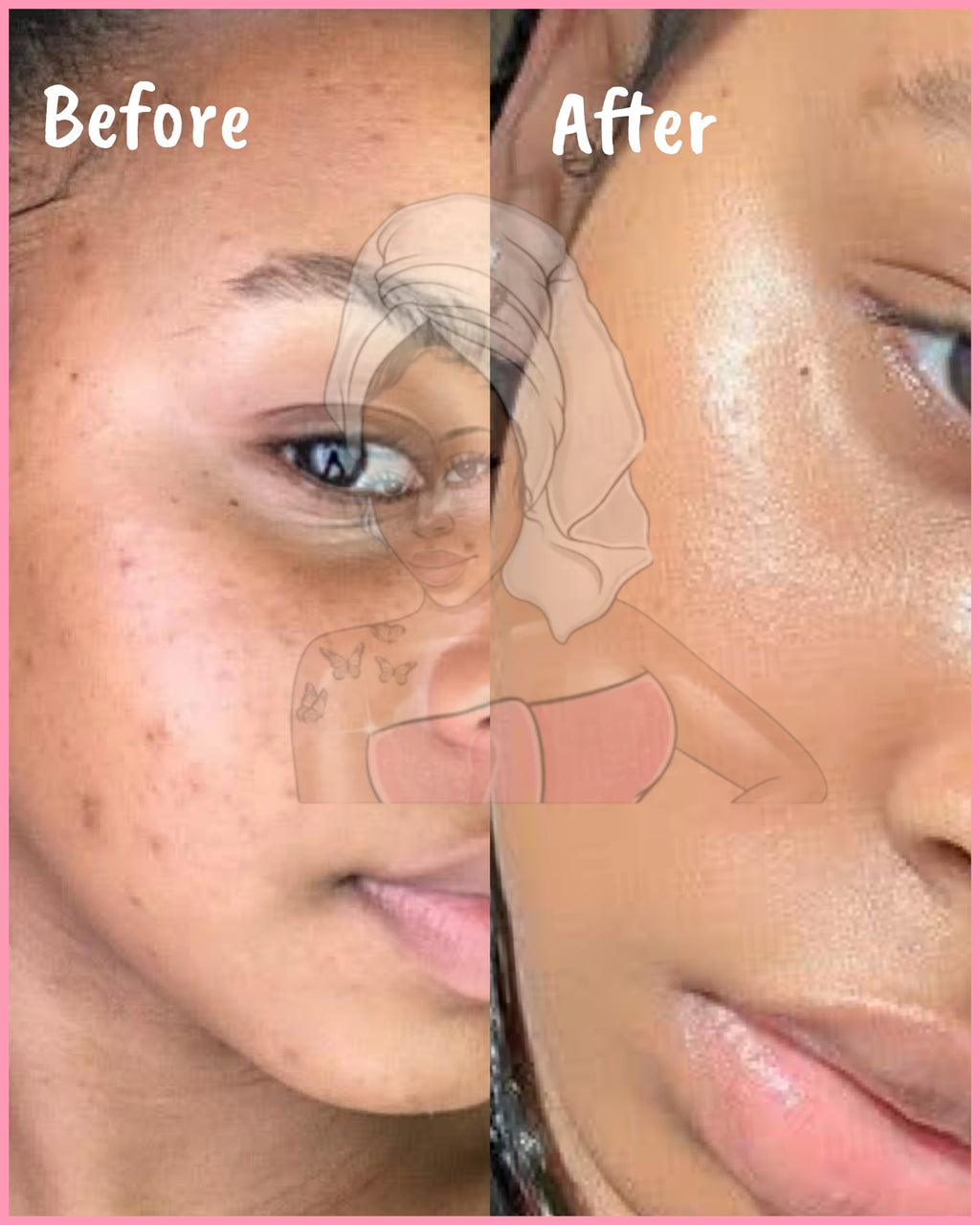 CHROMEBABEE BADDIE SERUM 💅🏼