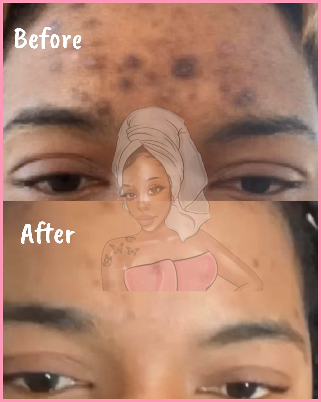 CHROMEBABEE BADDIE SERUM 💅🏼