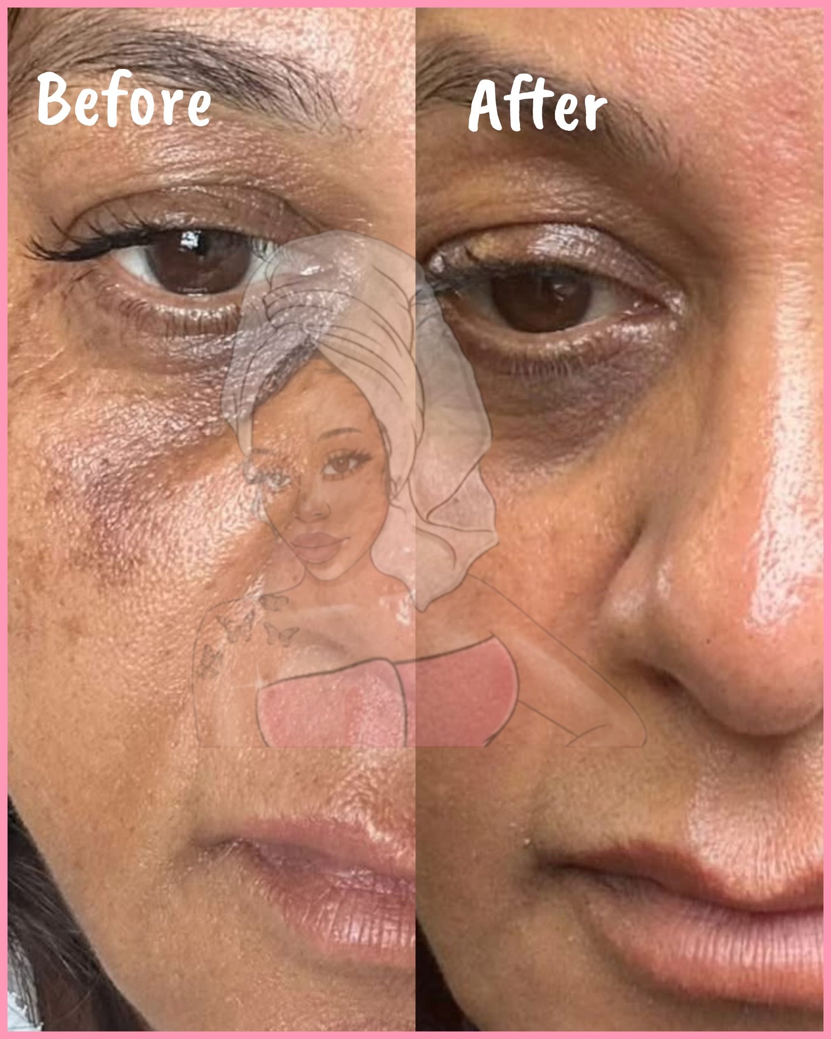 CHROMEBABEE BADDIE SERUM 💅🏼