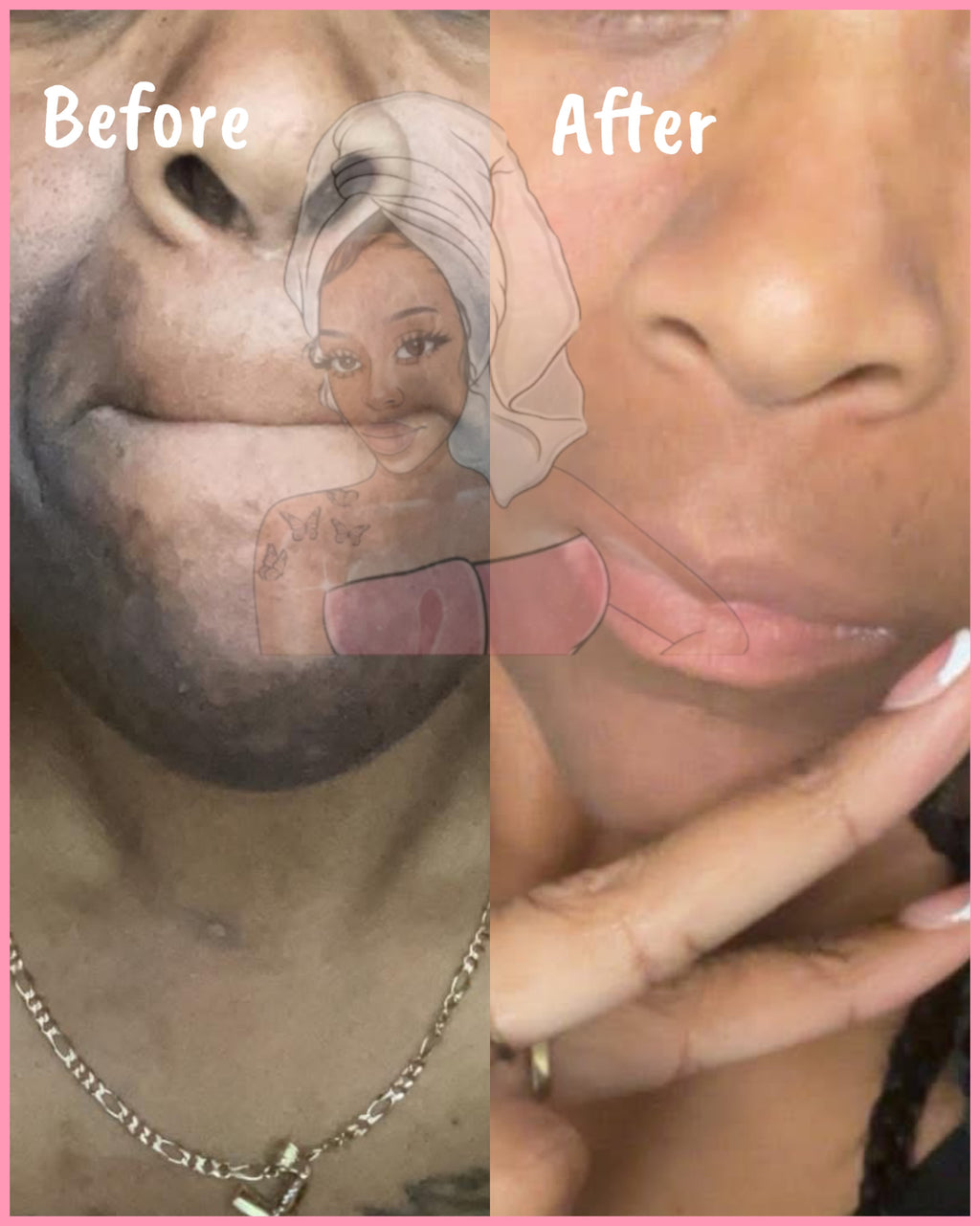 CHROMEBABEE BADDIE SERUM 💅🏼