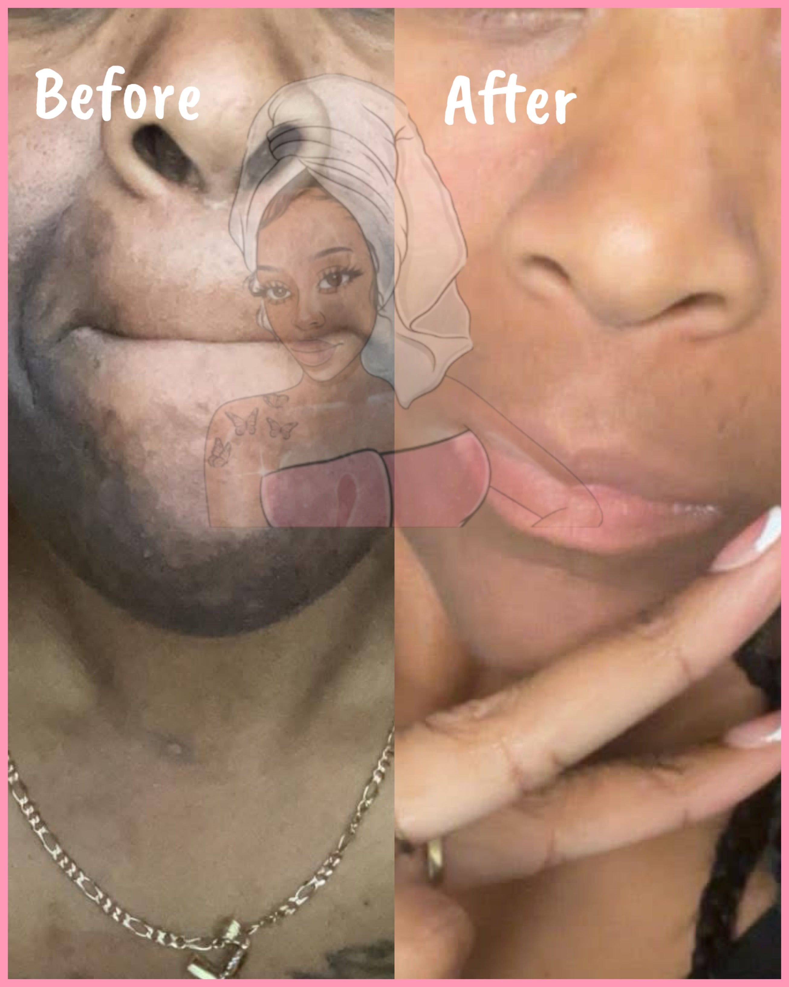 CHROMEBABEE BADDIE SERUM 💅🏼