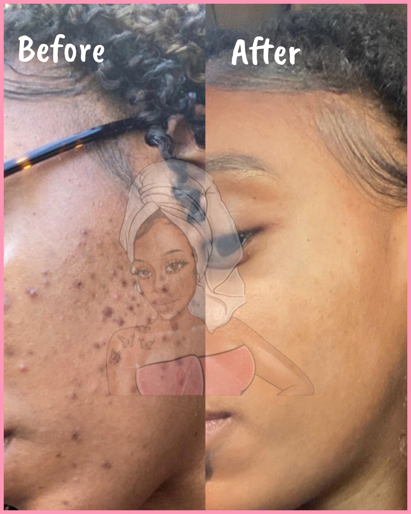 CHROMEBABEE BADDIE SERUM 💅🏼