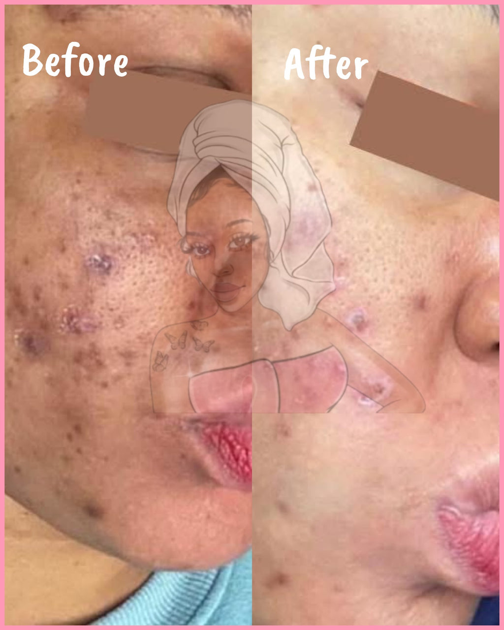 CHROMEBABEE BADDIE SERUM 💅🏼