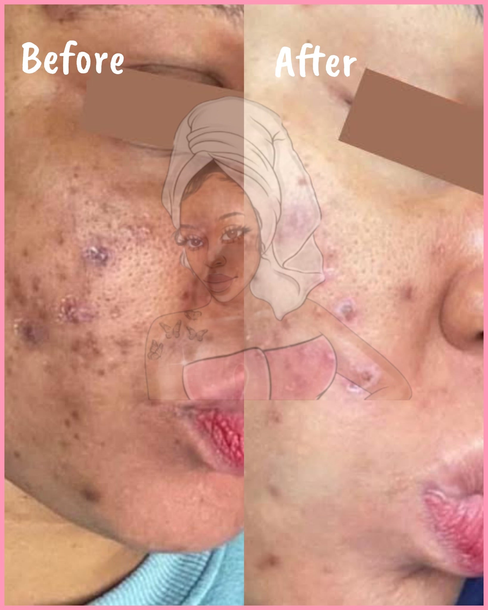 CHROMEBABEE BADDIE SERUM 💅🏼