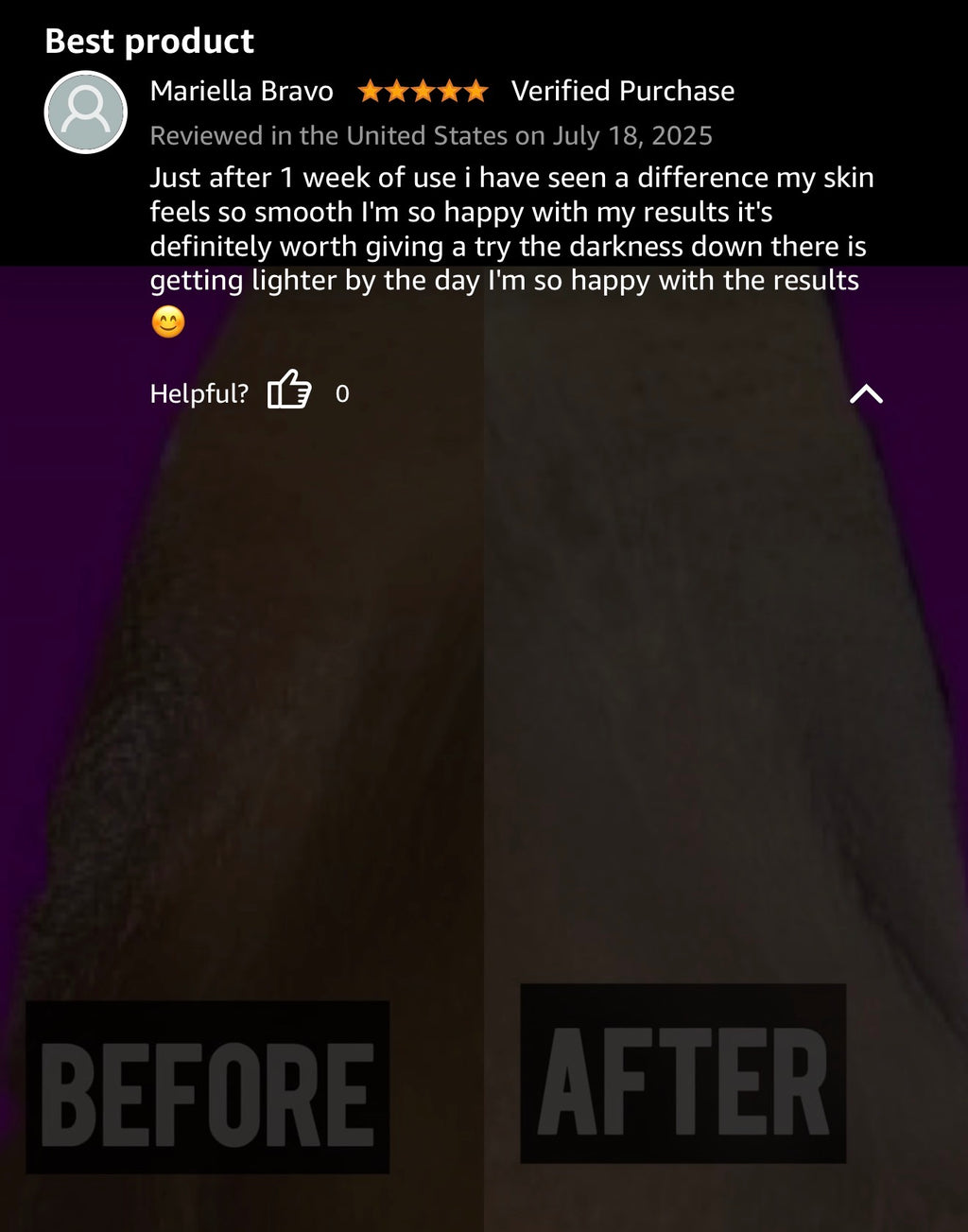 CHROMEBABEE BADDIE SERUM 💅🏼