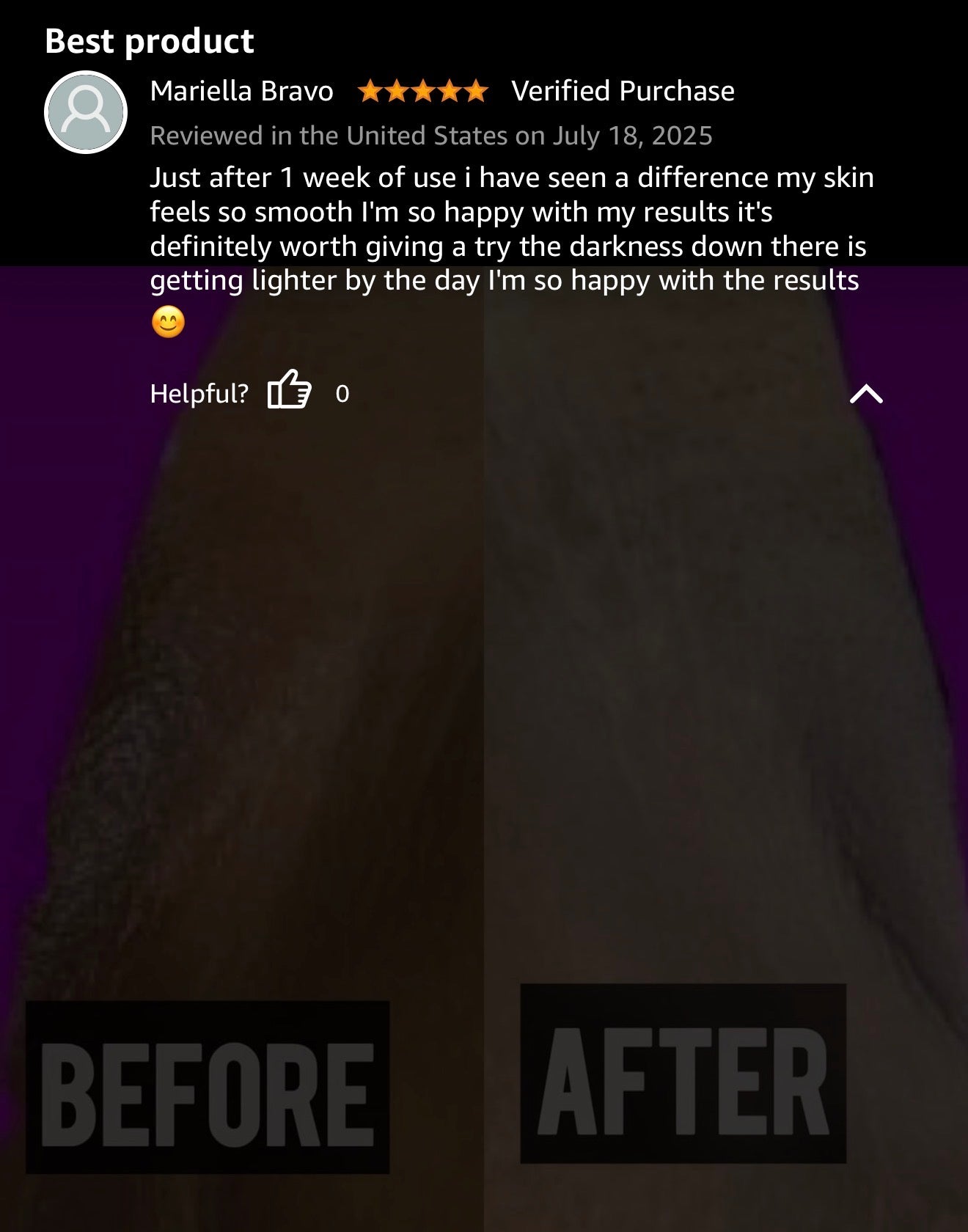 CHROMEBABEE BADDIE SERUM 💅🏼