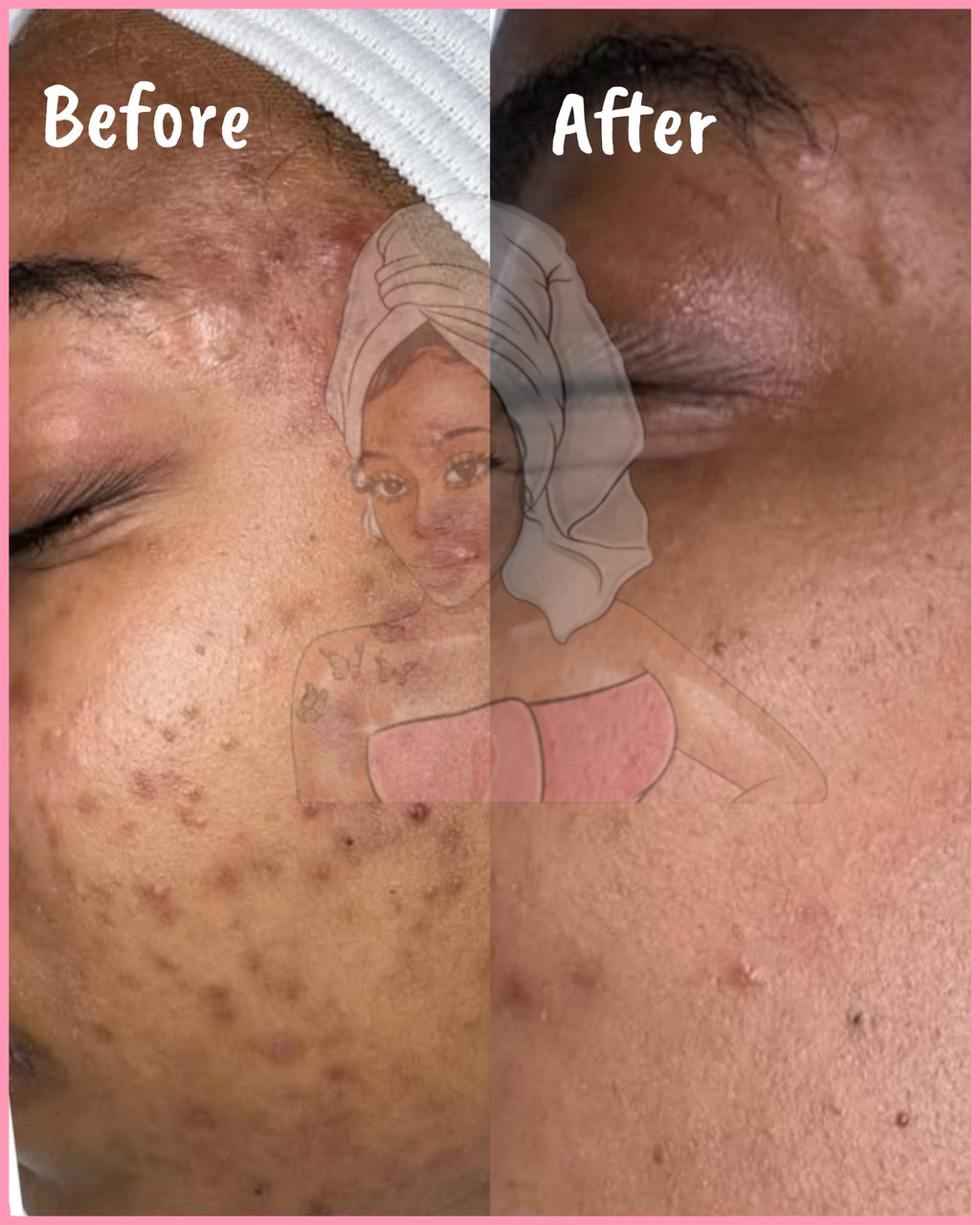 CHROMEBABEE BADDIE SERUM 💅🏼