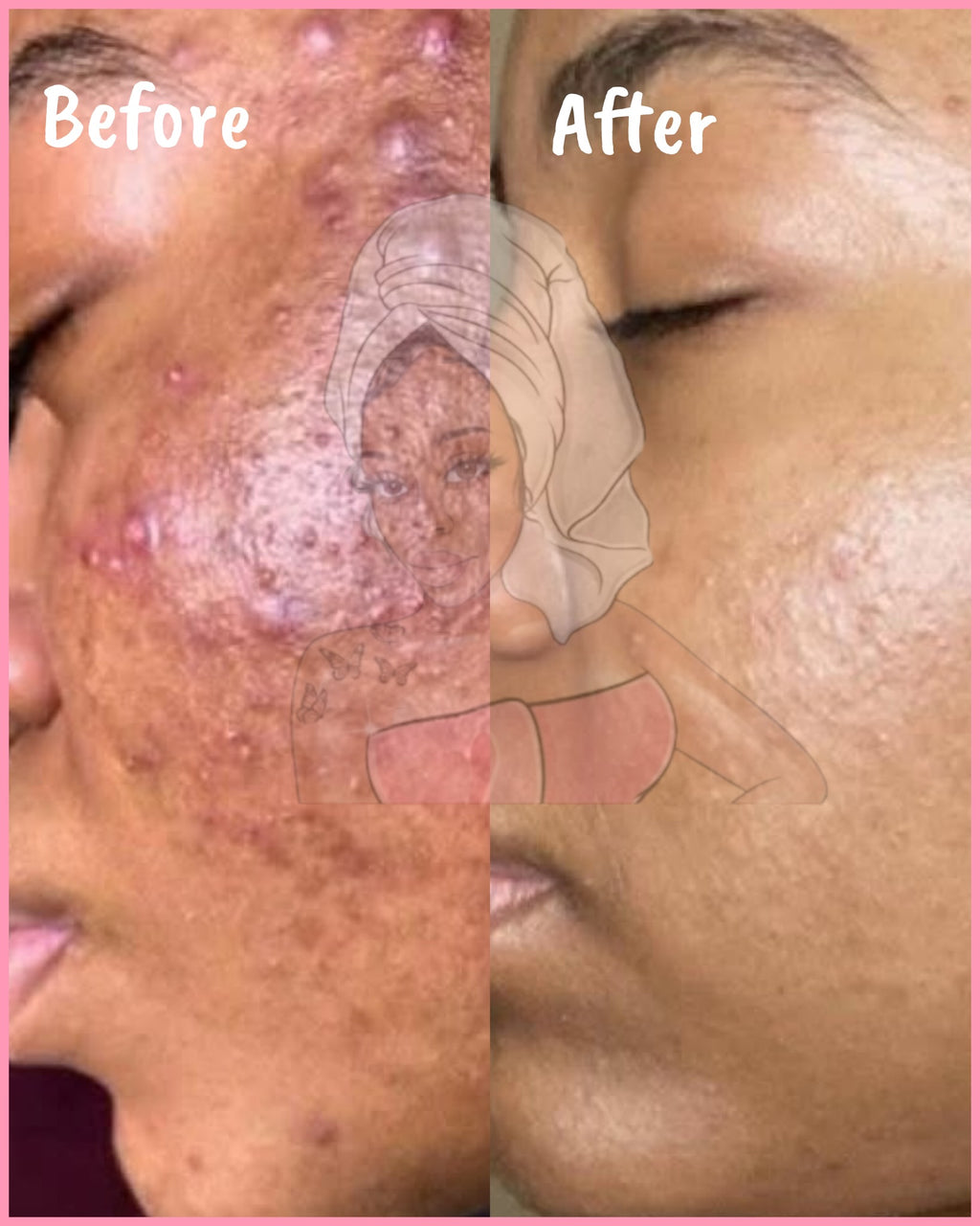 CHROMEBABEE BADDIE SERUM 💅🏼