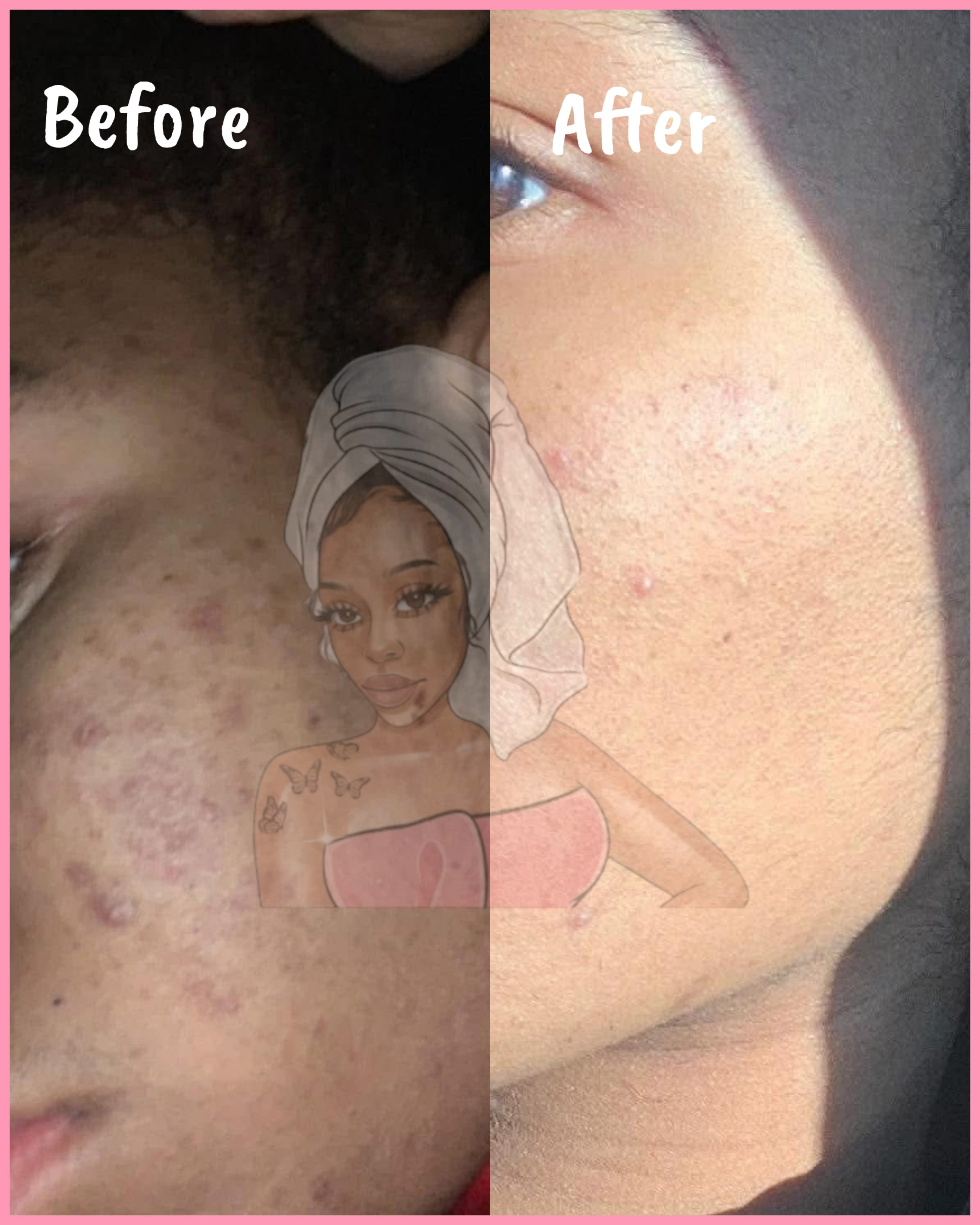 CHROMEBABEE BADDIE SERUM 💅🏼