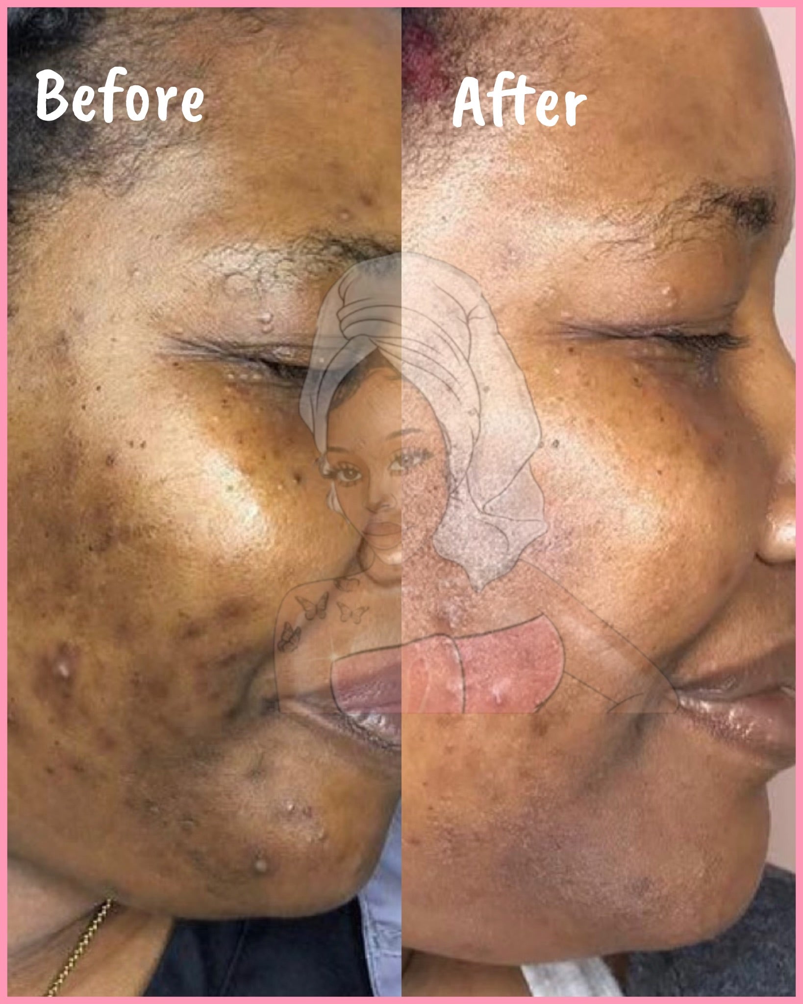 CHROMEBABEE BADDIE SERUM 💅🏼