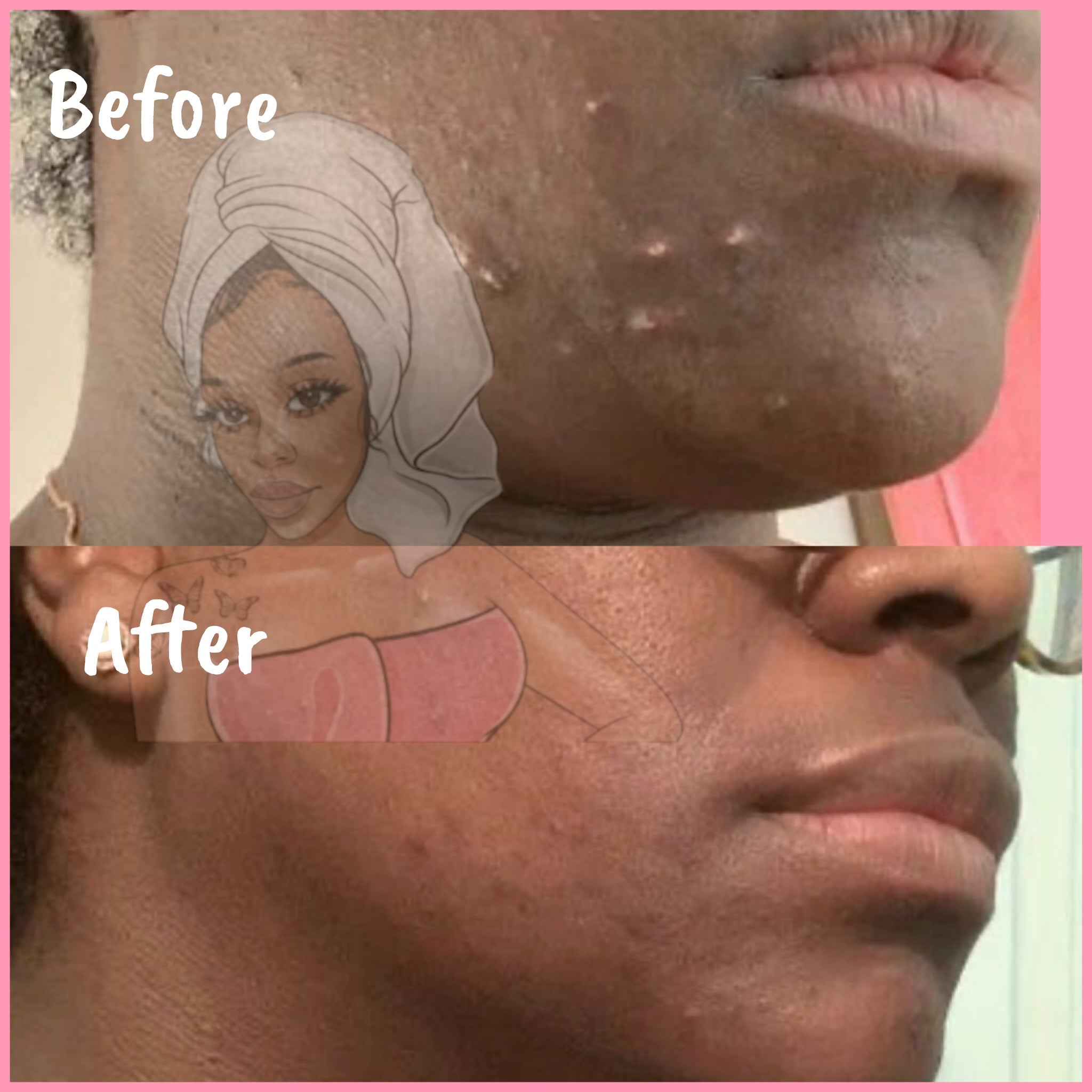 CHROMEBABEE BADDIE SERUM 💅🏼